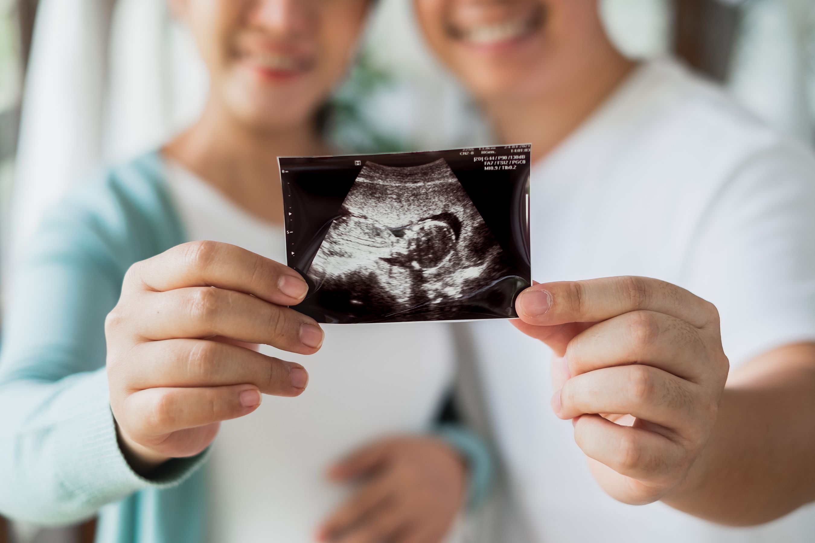 smiling couple hold up ultrasound image